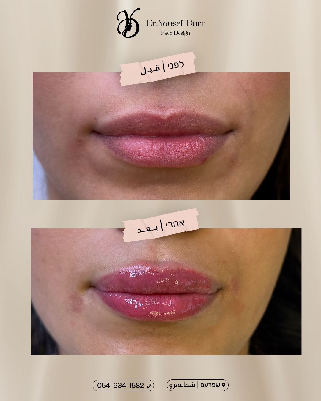 תוצאות טיפול