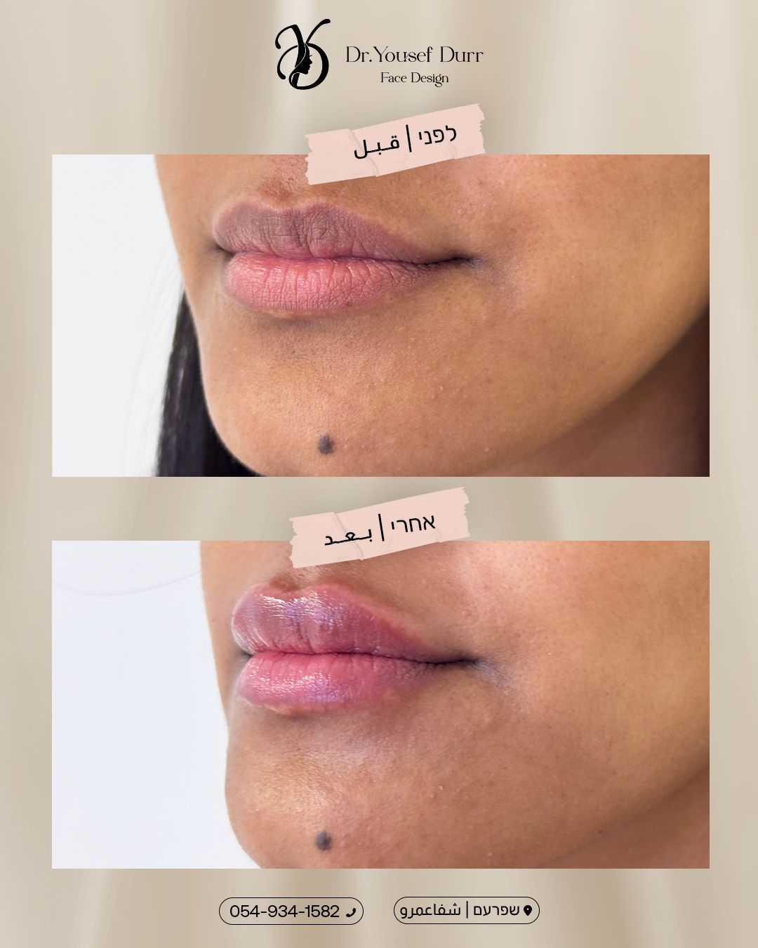 תוצאות טיפול