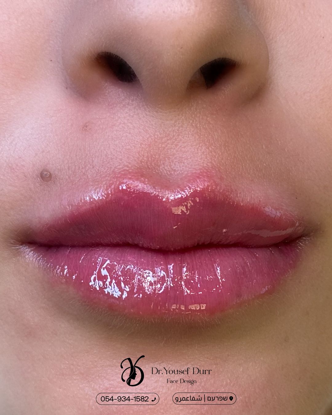 תוצאות טיפול