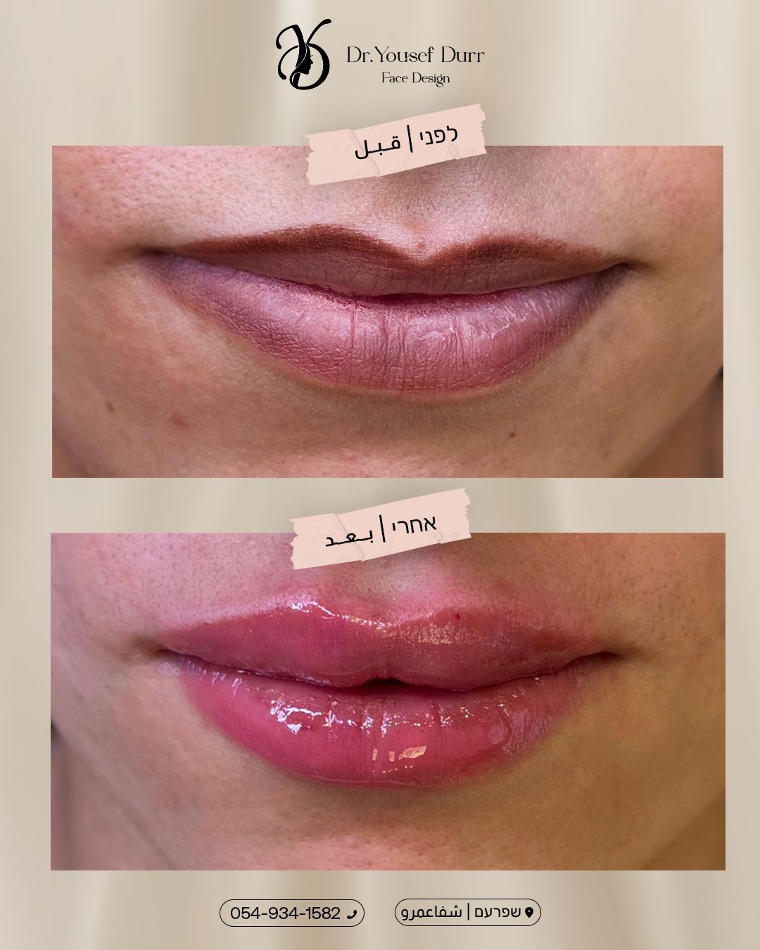 תוצאות טיפול