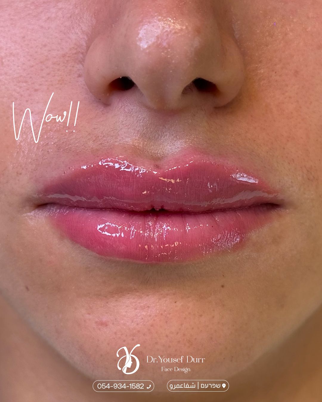 תוצאות טיפול