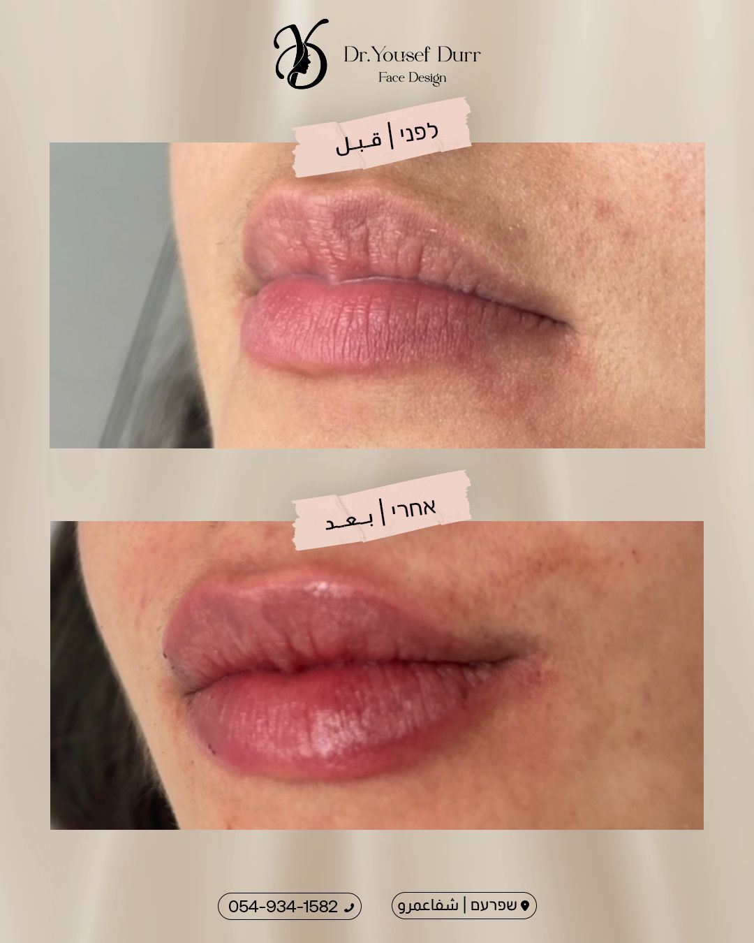 תוצאות טיפול