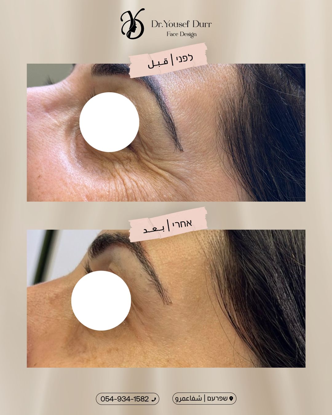 תוצאות טיפול