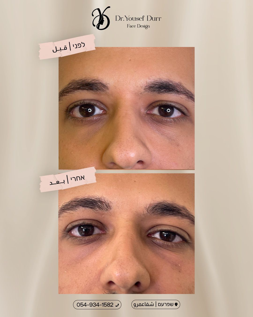 תוצאות טיפול