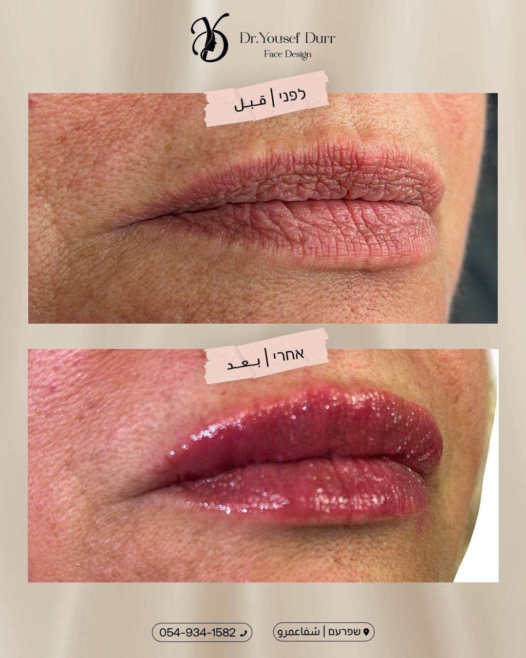 תוצאות טיפול