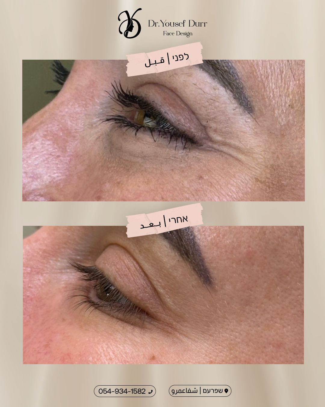 תוצאות טיפול