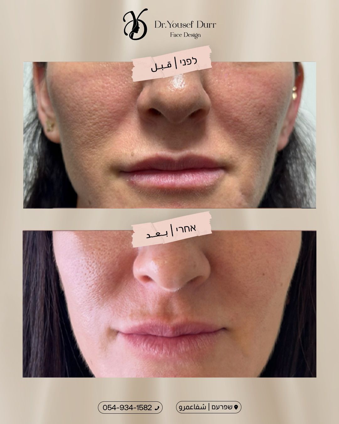 תוצאות טיפול