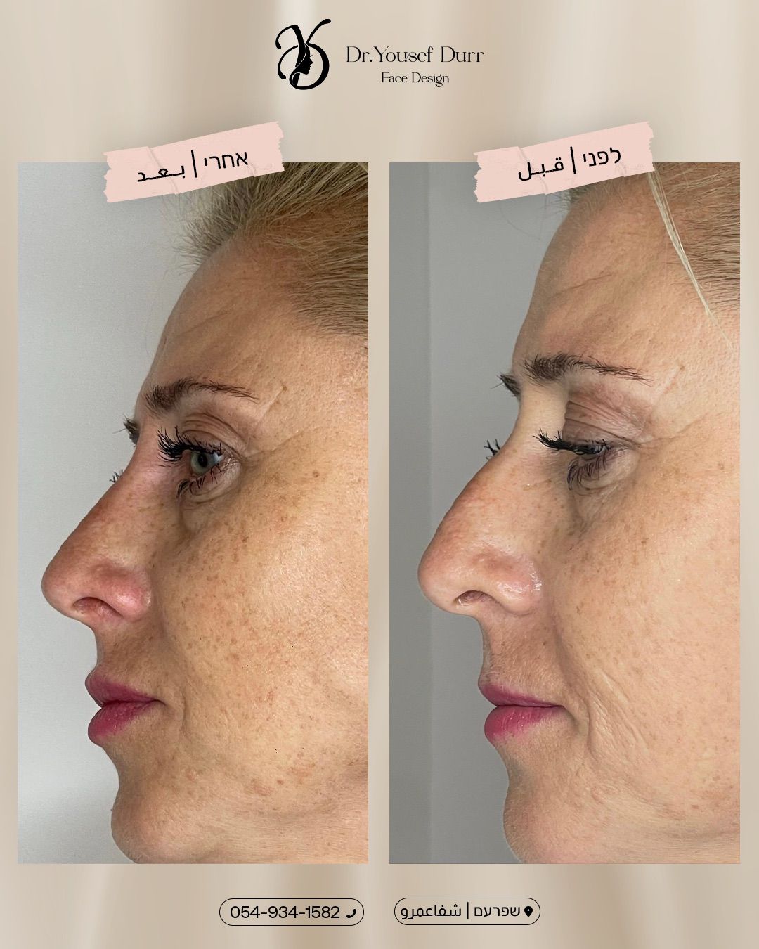 תוצאות טיפול