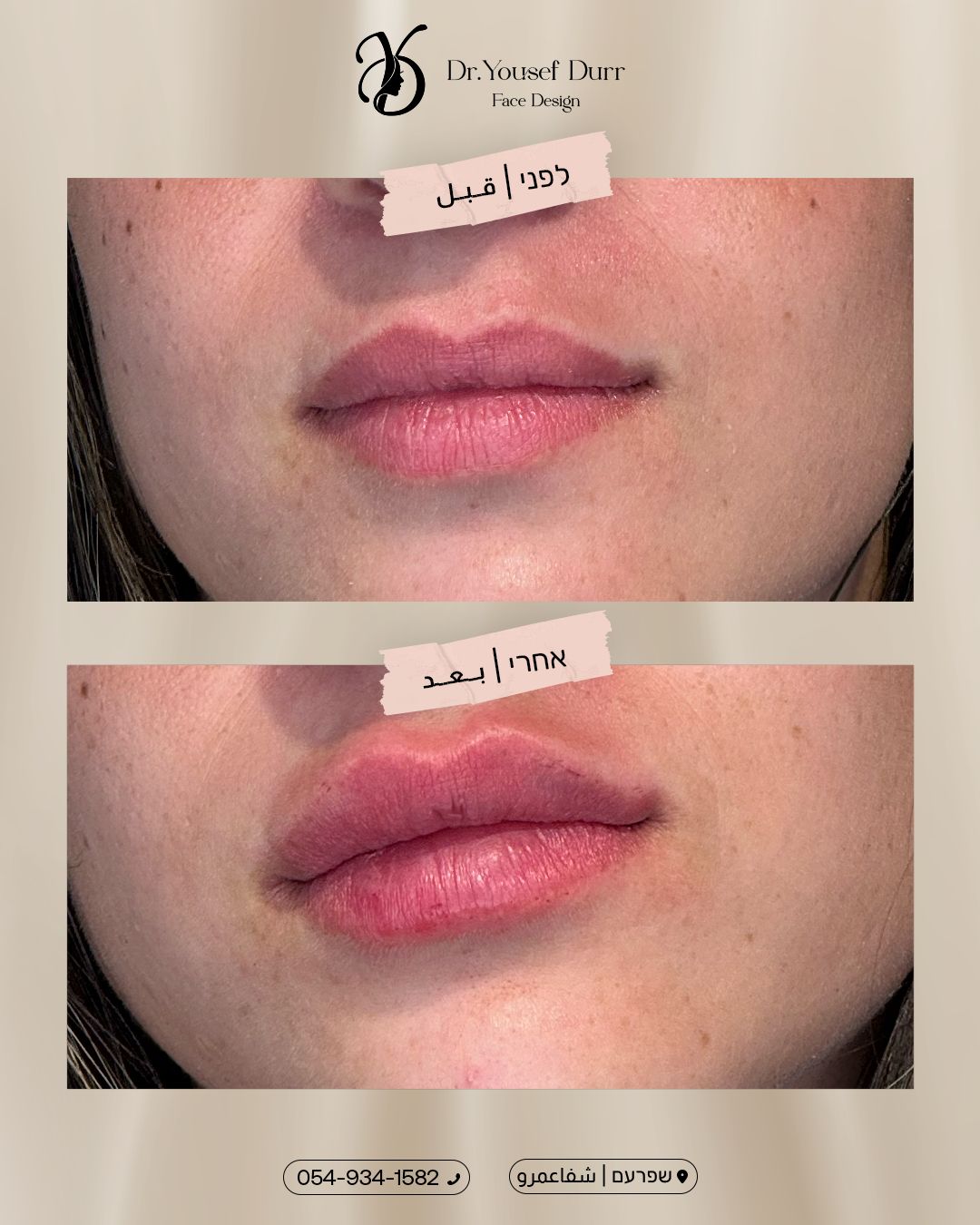 תוצאות טיפול