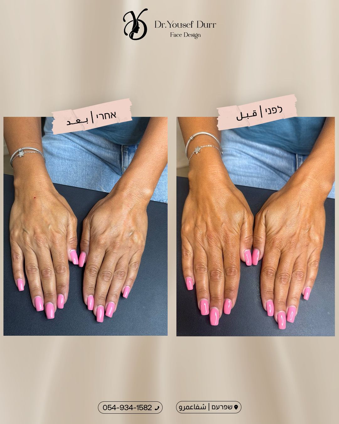 תוצאות טיפול