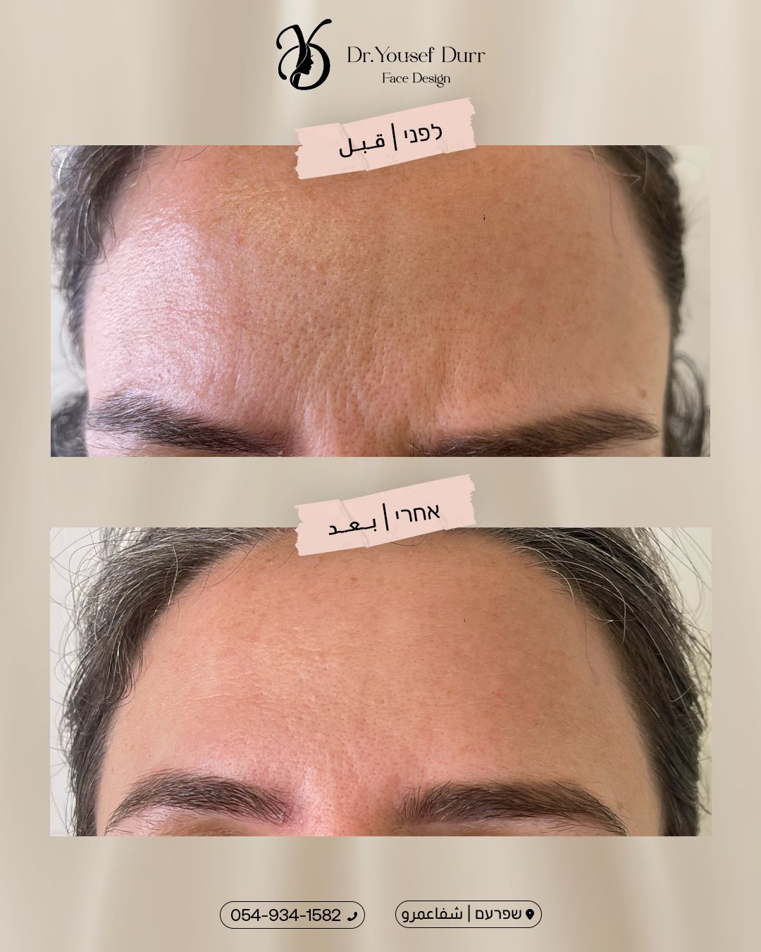 תוצאות טיפול