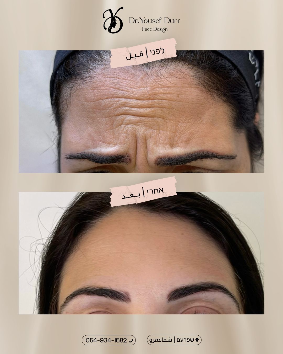 תוצאות טיפול